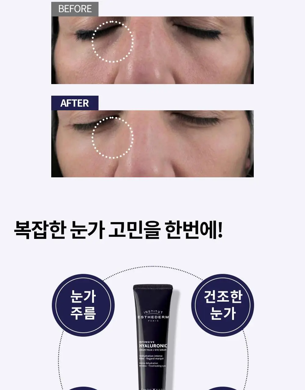 [괄사 아이세럼] 에스테덤 히알루로닉 아이세럼 15ml (주름개선기능성) 상세페이지 8
